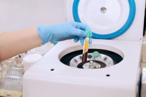 Gloved hand holding vial of blood near centrifuge 