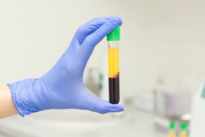 Gloved hand holding vial of processed blood