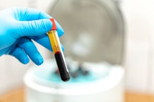 Gloved hand holding vial of processed blood in front of a centrifuge